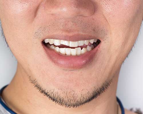 Orthodontics | Grace Family Dental | Airdrie Dentist