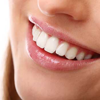 Porcelain Veneers | Grace Family Dental | Airdrie Dentist