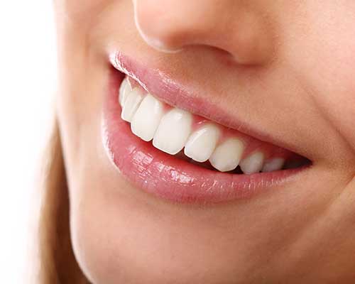 Porcelain Veneers | Grace Family Dental | Airdrie Dentist